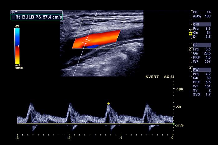 Echographie Doppler - Norimagerie